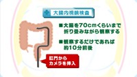 vol.57　大腸がん内視鏡検査について