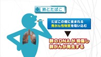 vol.83　増加傾向の肺がん
