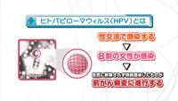 vol.88　子宮頸がんとHPV