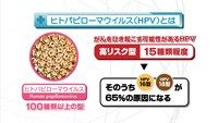 vol.113　子宮頸がんとHPV