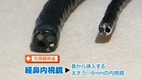 vol.122 胃がんの早期治療