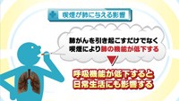 vol.133　肺がんの危険因子