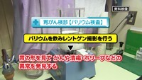 vol.151　胃がん検査について