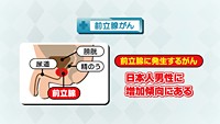 vol.190　前立腺がん検診