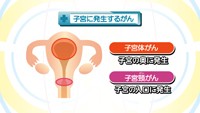vol.234　子宮頸がんとは？