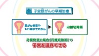 vol.236　子宮頸がん検診