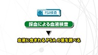 vol. 267　前立腺がん検診について