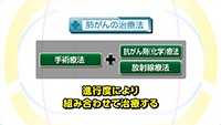 Vol. 280回　肺がんの治療法