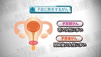 Vol. 282回　知りたい！子宮頸がん検診
