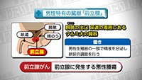 Vol. 290回　知りたい！前立腺がん検診