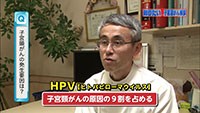 Vol. 306回　知りたい！子宮頸がん検診
