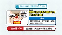 Vol. 314回　知りたい！前立腺がん検診