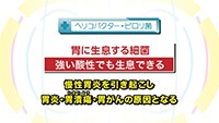 Vol. 343回　ピロリ菌と胃がん検診について