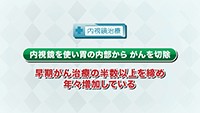Vol. 344回　胃がんの治療について