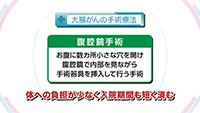 Vol. 348回　大腸がんの治療