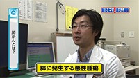 Vol. 350回　知りたい！肺がん検診