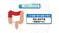 Vol. 371回　大腸がん検診について