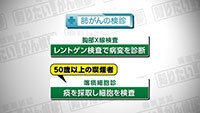 Vol. 375回　肺がん検診について