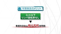 Vol. 376回　肺がんの治療法