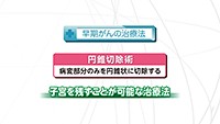 Vol. 380回　子宮頸がんの治療法