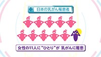 Vol. 382回　知りたい！乳がん検診