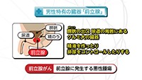 Vol. 386回　知りたい！前立腺がん検診