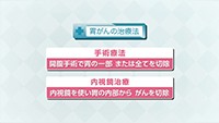 Vol. 392回　胃がんの治療について