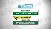 Vol. 399回　肺がん検診について
