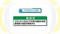 Vol. 403回　子宮頸がんの特徴