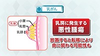 Vol. 406回　知りたい！乳がん検診