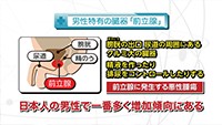 Vol. 410回　知りたい！前立腺がん