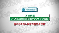Vol. 415回　胃がん検診について