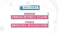 Vol. 416回　胃がんの治療について