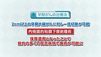 Vol. 420回　大腸がん検診について