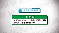 Vol. 427回「子宮頸がんの特徴」