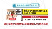 Vol. 434回「知りたい！前立腺がん検診」