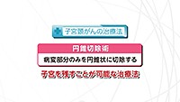 Vol.454回「子宮頸がんの治療」