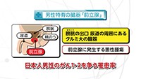 Vol. 460回「知りたい！前立腺がん検診」