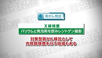 Vol. 465回「胃がん検診について」
