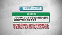 Vol. 477回「子宮頸がんの特徴」