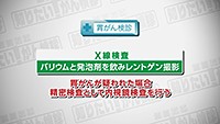 Vol. 489回「胃がん検診について」