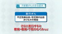 Vol. 525回「子宮頸がんの特徴」