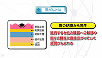 Vol. 536回「胃がんについて」