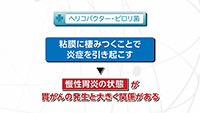 Vol. 561回「胃がん検診について」