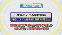 Vol. 564回「大腸がんとは」