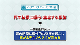 Vol. 632回「胃がんとは」
