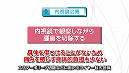 Vol.638回「大腸がんの治療法」
