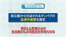Vol.653回「前立腺がんの検診について」