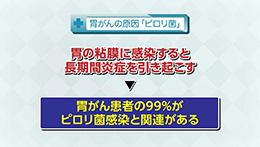 Vol.658回「胃がんの治療法」