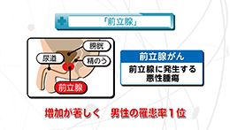 Vol.748回「前立腺がんとは」